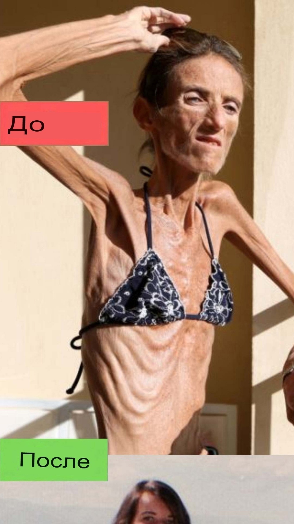 САМАЯ ХУДАЯ ЖЕНЩИНА В МИРЕ